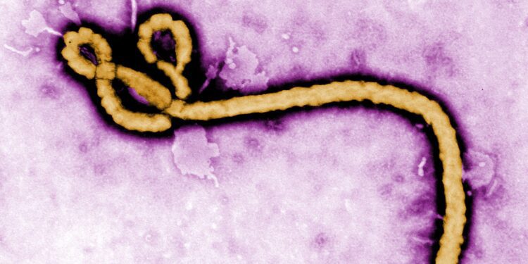 Ebola_virus_purple